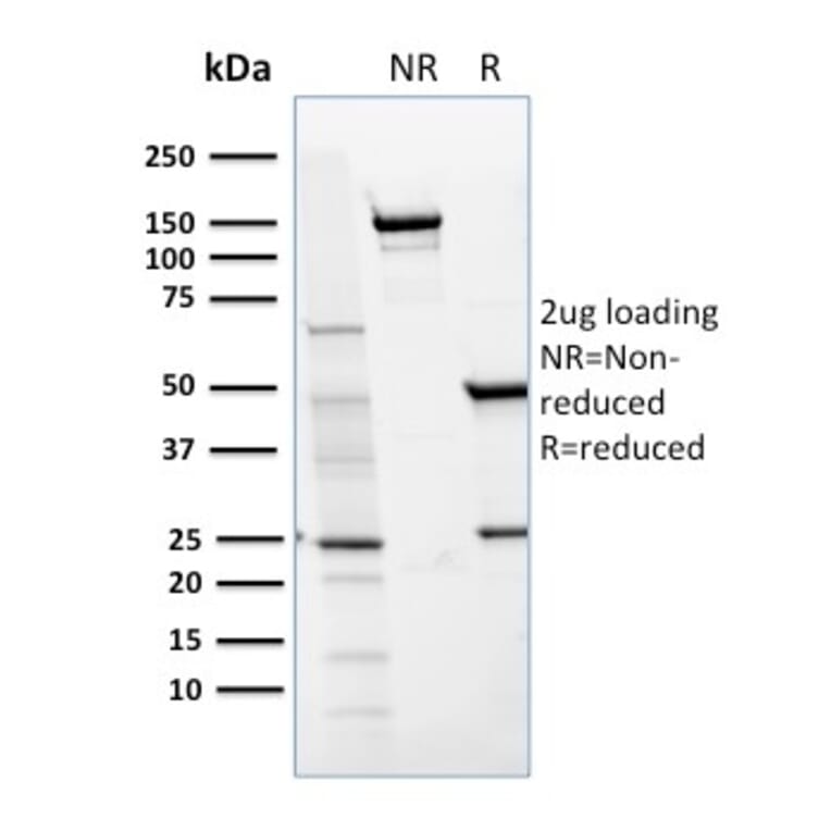 SDS-PAGE - Anti-CD36 Antibody [GPIIIb/1654] - BSA and Azide free (A253868) - Antibodies.com