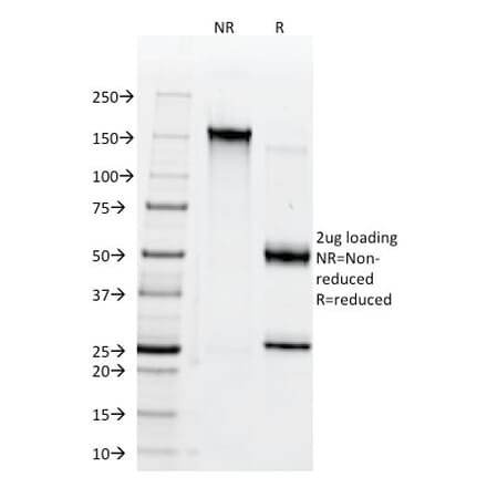 SDS-PAGE - Anti-CD38 Antibody [AT1] - BSA and Azide free (A253870) - Antibodies.com