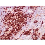 Immunohistochemistry - Anti-CD38 Antibody [CD38/4328] - BSA and Azide free (A253874) - Antibodies.com