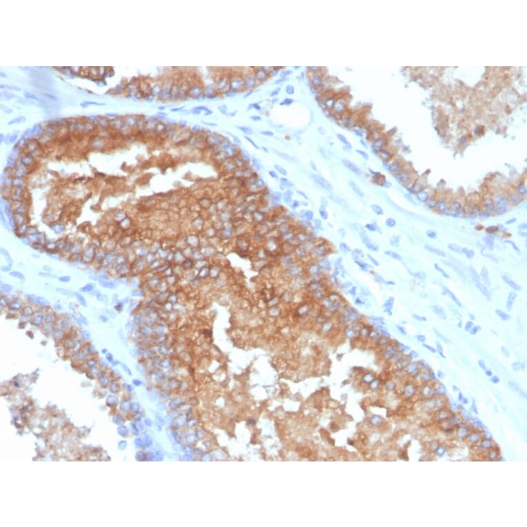 Immunohistochemistry - Anti-CD38 Antibody [CD38/4328] - BSA and Azide free (A253874) - Antibodies.com