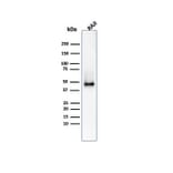 Western Blot - Anti-CD38 Antibody [CD38/4328] - BSA and Azide free (A253874) - Antibodies.com