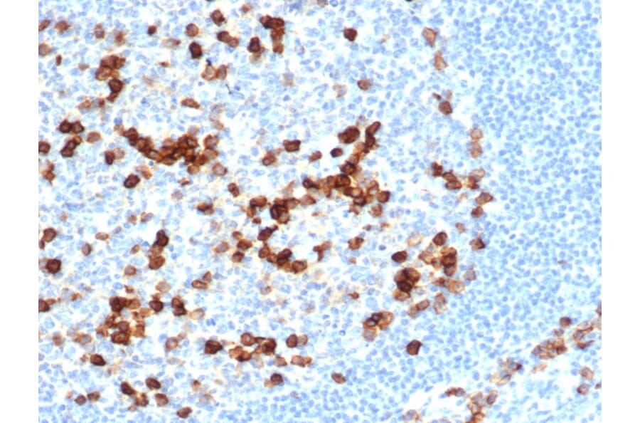 Immunohistochemistry - Anti-CD38 Antibody [CD38/6448R] - BSA and Azide free (A253875) - Antibodies.com