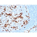 Immunohistochemistry - Anti-CD38 Antibody [CD38/6448R] - BSA and Azide free (A253875) - Antibodies.com