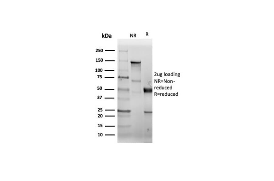 SDS-PAGE - Anti-CD38 Antibody [CD38/6448R] - BSA and Azide free (A253876) - Antibodies.com