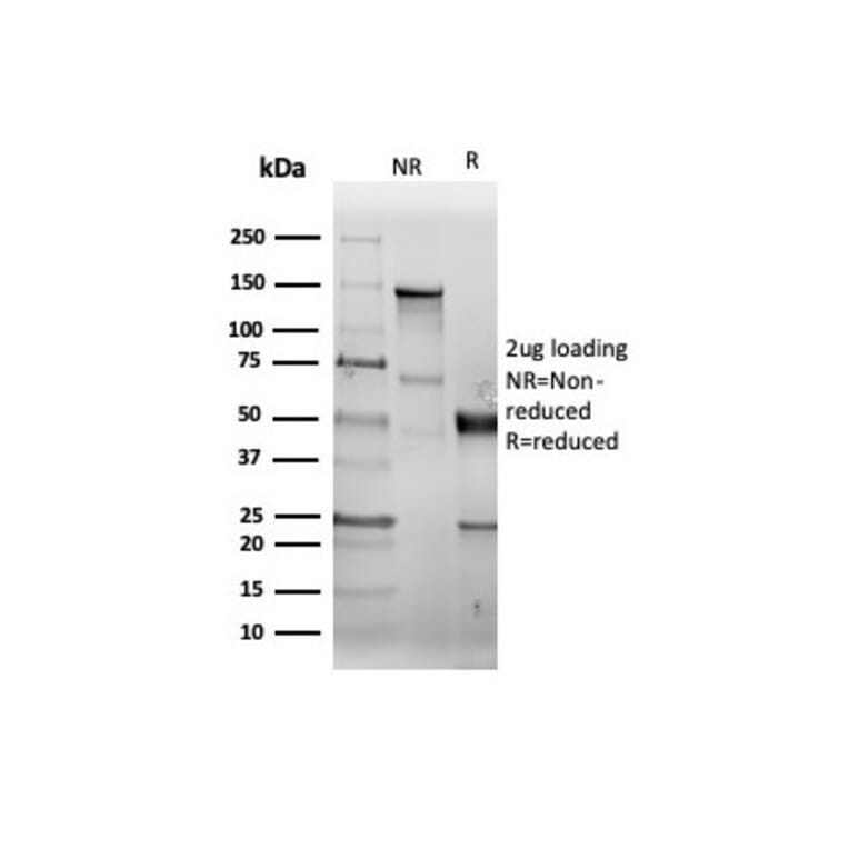 SDS-PAGE - Anti-CD38 Antibody [CD38/6448R] - BSA and Azide free (A253876) - Antibodies.com