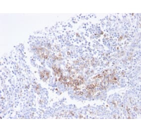 Immunohistochemistry - Anti-CD38 Antibody [CD38/4247R] - BSA and Azide free (A253877) - Antibodies.com