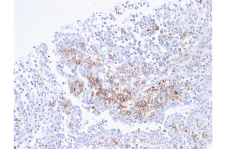 Immunohistochemistry - Anti-CD38 Antibody [CD38/4247R] - BSA and Azide free (A253877) - Antibodies.com