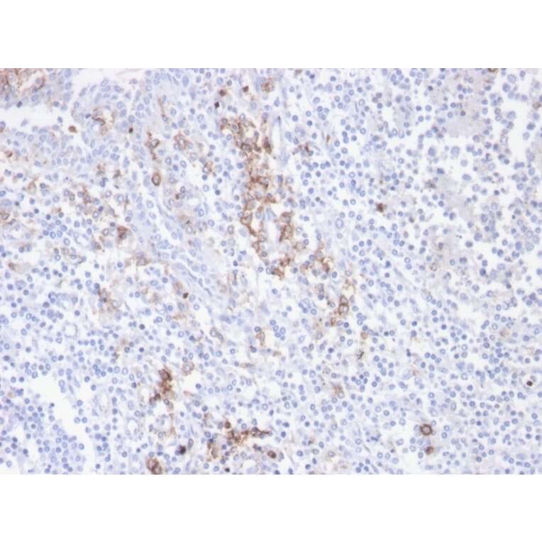 Immunohistochemistry - Anti-CD38 Antibody [CD38/4247R] - BSA and Azide free (A253876) - Antibodies.com