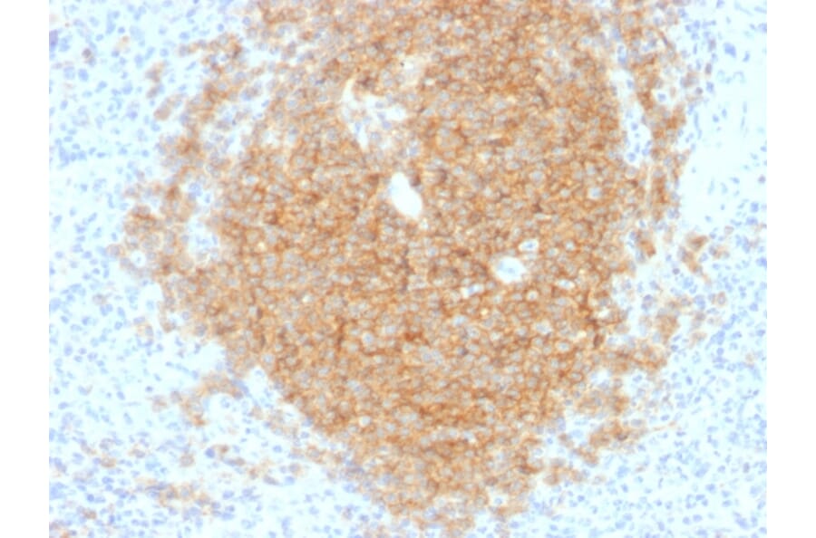 Immunohistochemistry - Anti-CD40 Antibody [C40/1605] - BSA and Azide free (A253878) - Antibodies.com