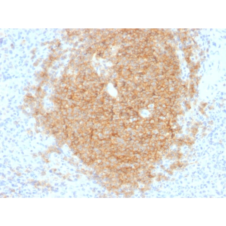 Immunohistochemistry - Anti-CD40 Antibody [C40/1605] - BSA and Azide free (A253878) - Antibodies.com