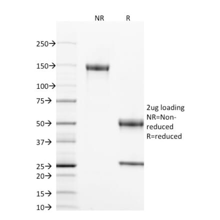 SDS-PAGE - Anti-CD40 Antibody [T8P2G4*A6] - BSA and Azide free (A253878) - Antibodies.com