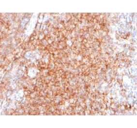 Immunohistochemistry - Anti-CD40 Antibody [C40/2383] - BSA and Azide free (A253880) - Antibodies.com