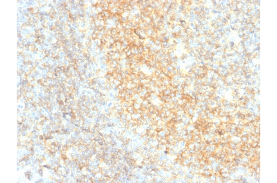Immunohistochemistry - Anti-CD40 Antibody [C40/4826R] - BSA and Azide free (A253881) - Antibodies.com