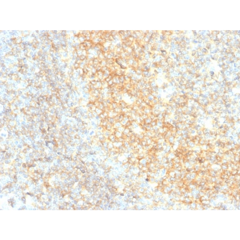 Immunohistochemistry - Anti-CD40 Antibody [C40/4826R] - BSA and Azide free (A253881) - Antibodies.com