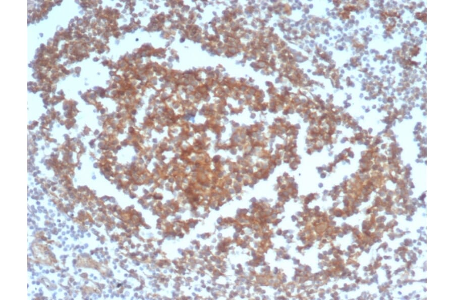 Immunohistochemistry - Anti-CD40 Antibody [C40/4826R] - BSA and Azide free (A253880) - Antibodies.com