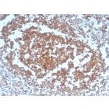 Immunohistochemistry - Anti-CD40 Antibody [C40/4826R] - BSA and Azide free (A253880) - Antibodies.com