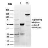 SDS-PAGE - Anti-CD40 Antibody [C40/4826R] - BSA and Azide free (A253881) - Antibodies.com