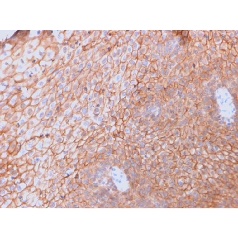 Immunohistochemistry - Anti-CD40L Antibody [CD40LG/2761] - BSA and Azide free (A253882) - Antibodies.com