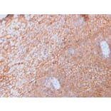 Immunohistochemistry - Anti-CD40L Antibody [CD40LG/2761] - BSA and Azide free (A253882) - Antibodies.com