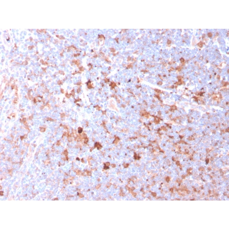Immunohistochemistry - Anti-CD40L Antibody [CD40LG/2761] - BSA and Azide free (A253882) - Antibodies.com