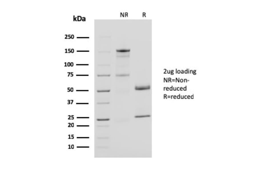 SDS-PAGE - Anti-CD40L Antibody [CD40LG/2761] - BSA and Azide free (A253882) - Antibodies.com