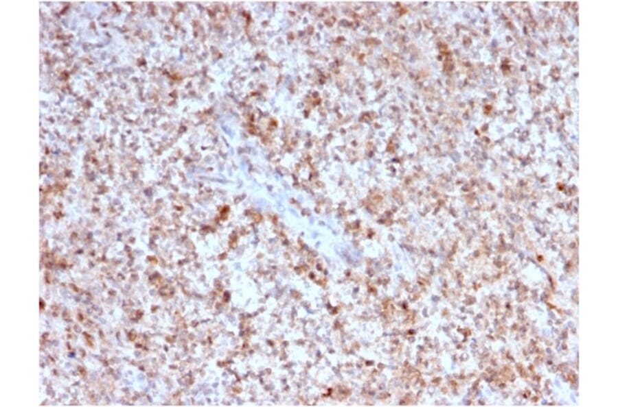 Immunohistochemistry - Anti-CD40L Antibody [CD40LG/2763] - BSA and Azide free (A253883) - Antibodies.com