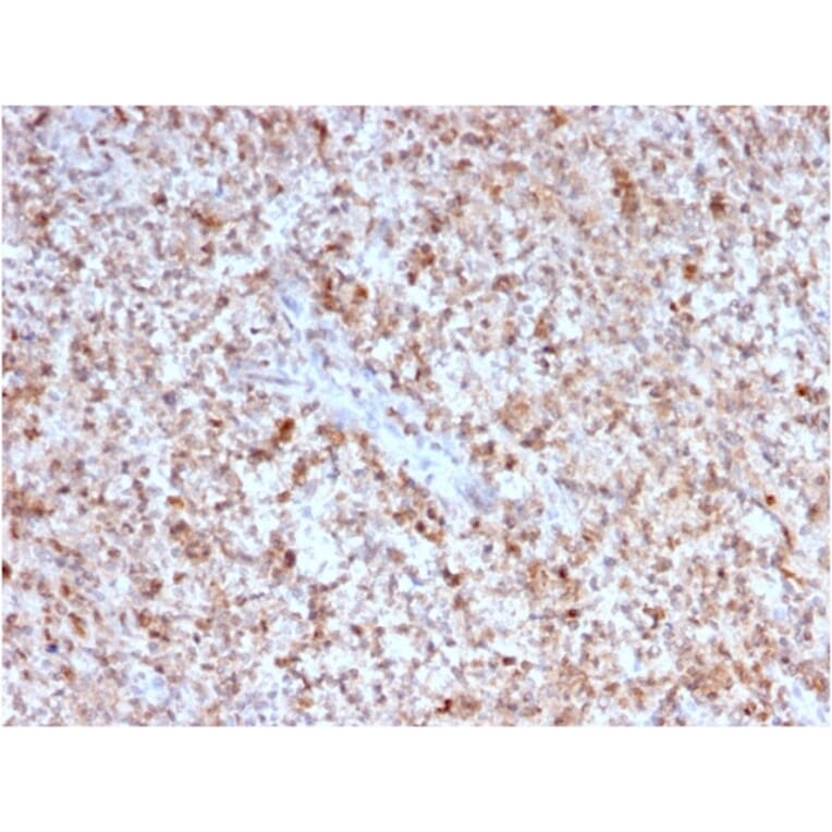 Immunohistochemistry - Anti-CD40L Antibody [CD40LG/2763] - BSA and Azide free (A253883) - Antibodies.com