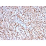 Immunohistochemistry - Anti-CD40L Antibody [CD40LG/2763] - BSA and Azide free (A253883) - Antibodies.com