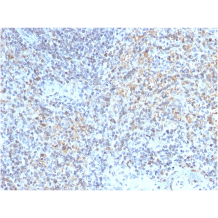 Immunohistochemistry - Anti-CD40L Antibody [CD40LG/2763] - BSA and Azide free (A253883) - Antibodies.com