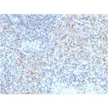 Immunohistochemistry - Anti-CD40L Antibody [CD40LG/2763] - BSA and Azide free (A253883) - Antibodies.com