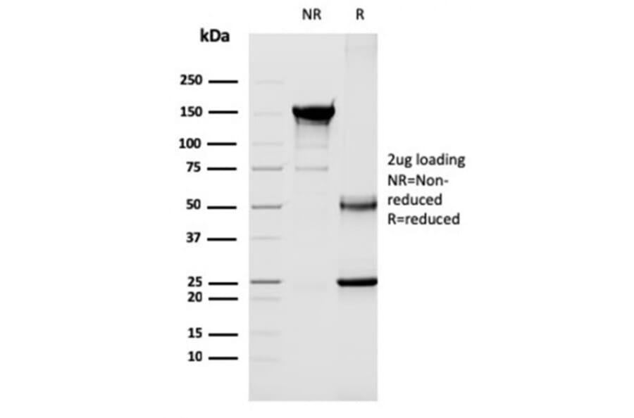 SDS-PAGE - Anti-CD40L Antibody [CD40LG/2763] - BSA and Azide free (A253883) - Antibodies.com