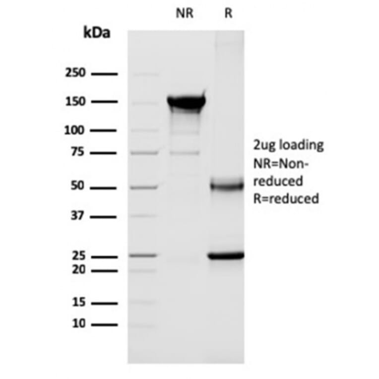 SDS-PAGE - Anti-CD40L Antibody [CD40LG/2763] - BSA and Azide free (A253883) - Antibodies.com