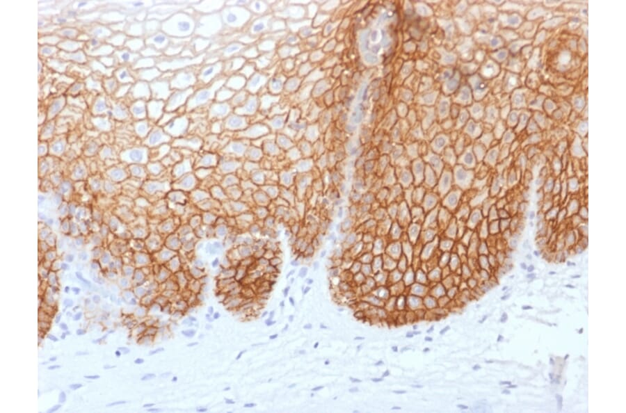 Immunohistochemistry - Anti-CD44v9 Antibody [rCD44v9/1459] - BSA and Azide free (A253885) - Antibodies.com