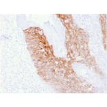 Immunohistochemistry - Anti-CD44v6 Antibody [CD44V6/2496] - BSA and Azide free (A253887) - Antibodies.com