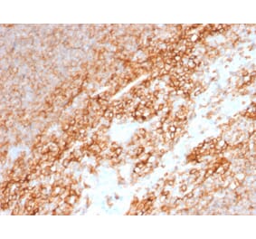 Immunohistochemistry - Anti-CD44 Antibody [BU75] - BSA and Azide free (A253888) - Antibodies.com