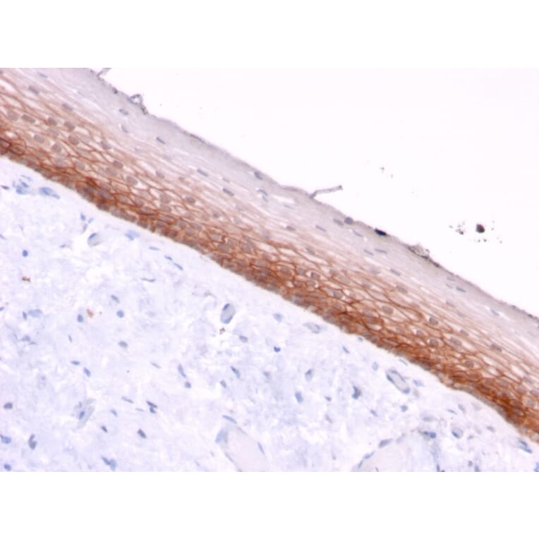Immunohistochemistry - Anti-CD44v4/5 Antibody [3D2] - BSA and Azide free (A253890) - Antibodies.com