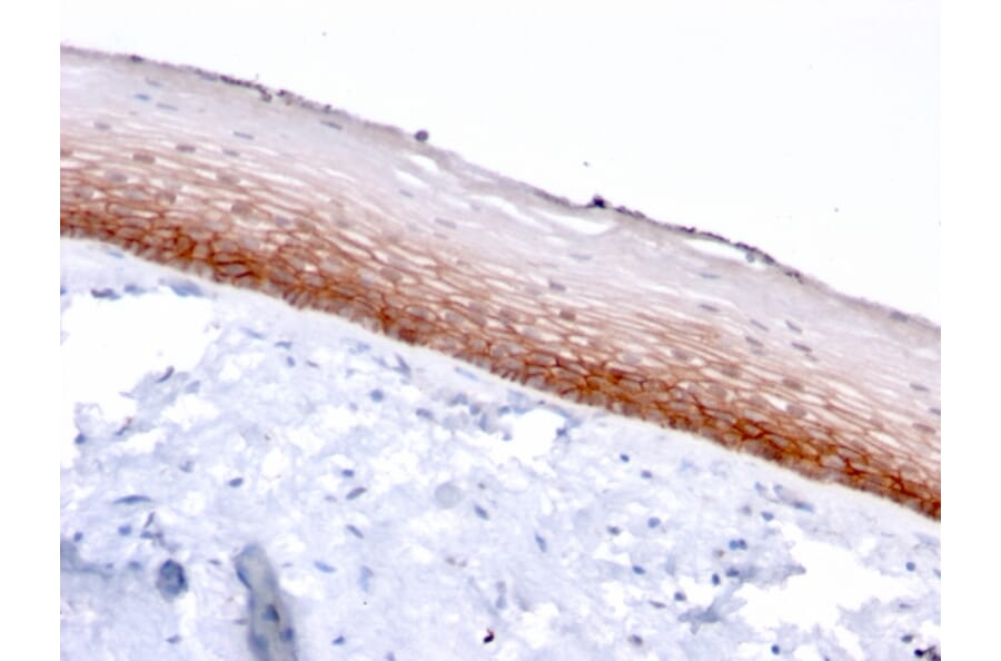Immunohistochemistry - Anti-CD44v4/5 Antibody [3D2] - BSA and Azide free (A250710) - Antibodies.com