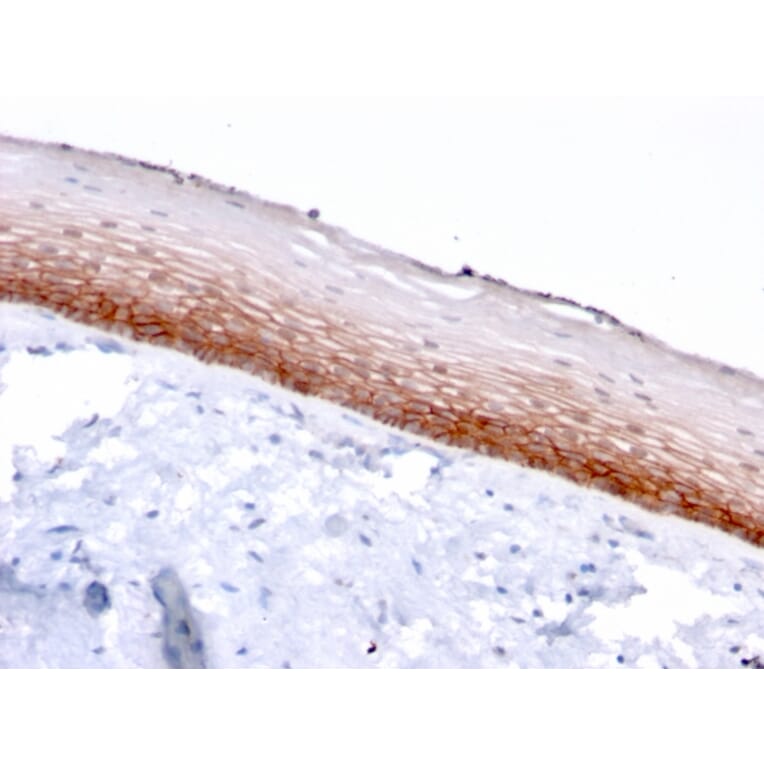 Immunohistochemistry - Anti-CD44v4/5 Antibody [3D2] - BSA and Azide free (A250710) - Antibodies.com