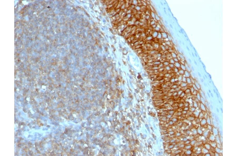 Immunohistochemistry - Anti-CD44 Antibody [SPM544] - BSA and Azide free (A253891) - Antibodies.com