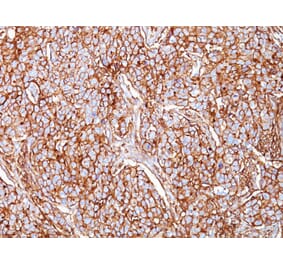 Immunohistochemistry - Anti-CD44 Antibody [SPM521] - BSA and Azide free (A253892) - Antibodies.com