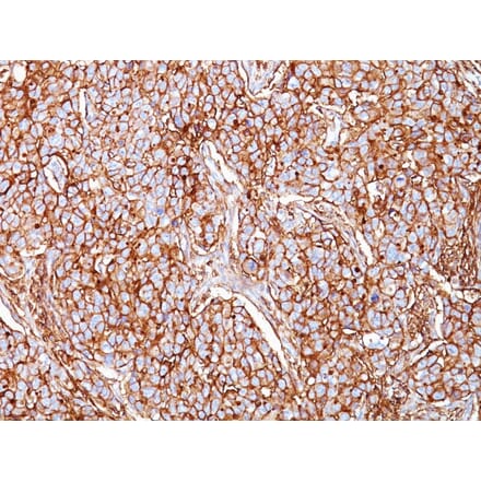 Immunohistochemistry - Anti-CD44 Antibody [SPM521] - BSA and Azide free (A253892) - Antibodies.com
