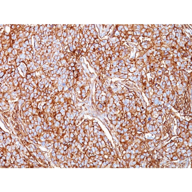 Immunohistochemistry - Anti-CD44 Antibody [SPM521] - BSA and Azide free (A253892) - Antibodies.com
