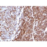 Immunohistochemistry - Anti-CD44 Antibody [rHCAM/918] - BSA and Azide free (A253894) - Antibodies.com