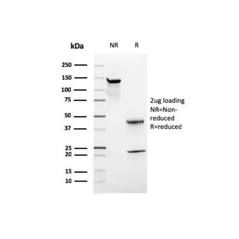 SDS-PAGE - Anti-CD44 Antibody [rHCAM/918] - BSA and Azide free (A253894) - Antibodies.com