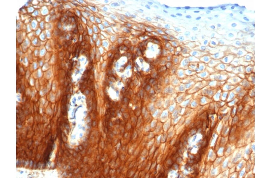 Immunohistochemistry - Anti-CD44 Antibody [rHCAM/6449] - BSA and Azide free (A253895) - Antibodies.com