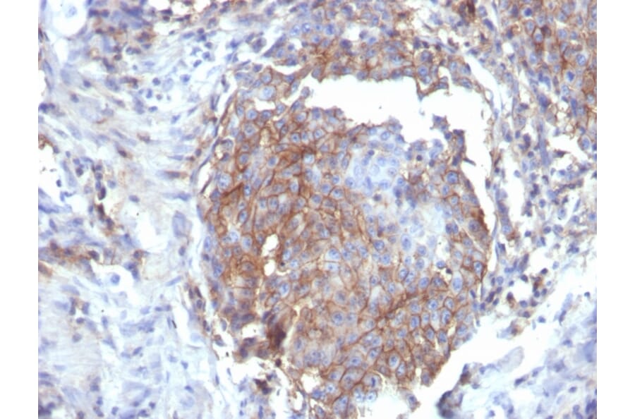 Immunohistochemistry - Anti-CD44 Antibody [rHCAM/6449] - BSA and Azide free (A253894) - Antibodies.com