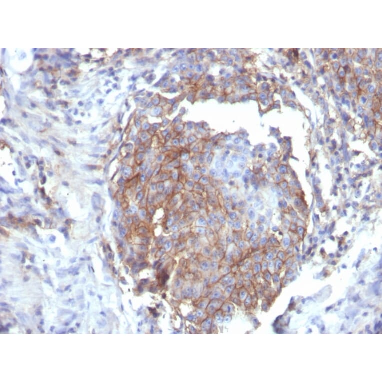 Immunohistochemistry - Anti-CD44 Antibody [rHCAM/6449] - BSA and Azide free (A253894) - Antibodies.com
