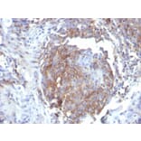 Immunohistochemistry - Anti-CD44 Antibody [rHCAM/6449] - BSA and Azide free (A253894) - Antibodies.com