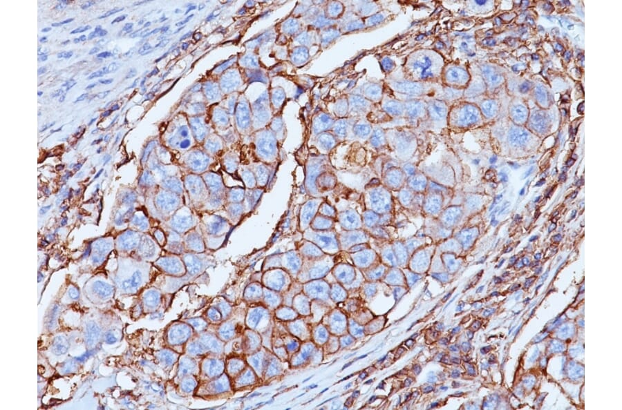 Immunohistochemistry - Anti-CD44 Antibody [DF1485] - BSA and Azide free (A253897) - Antibodies.com