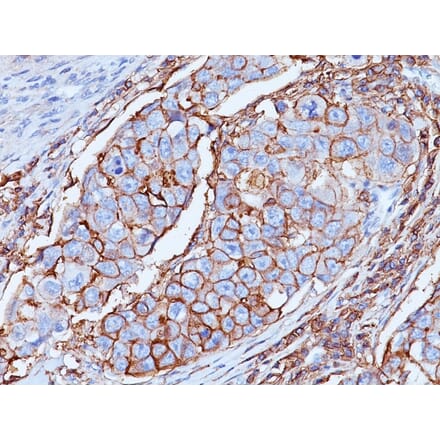 Immunohistochemistry - Anti-CD44 Antibody [DF1485] - BSA and Azide free (A253897) - Antibodies.com